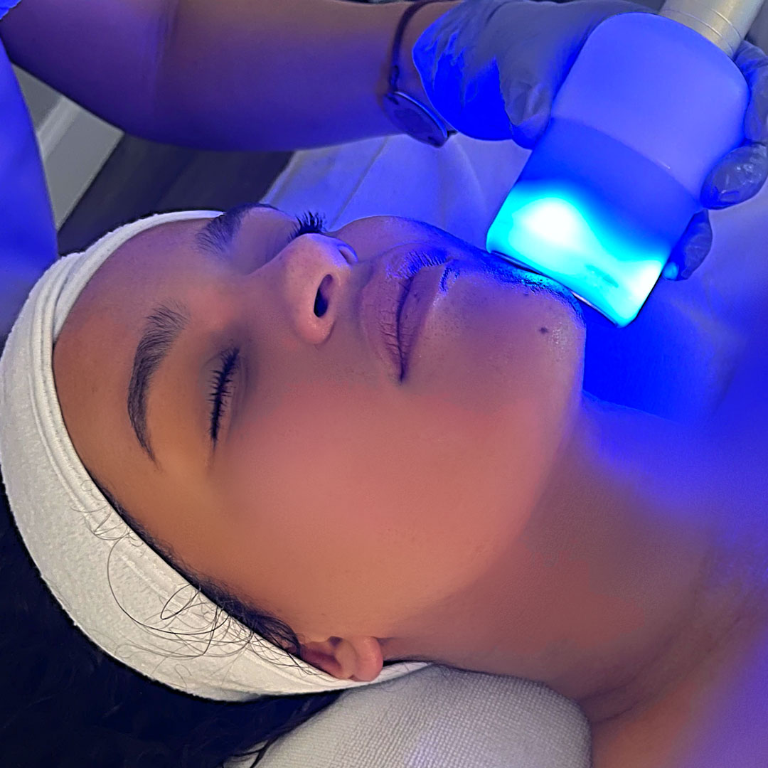 cryo-face