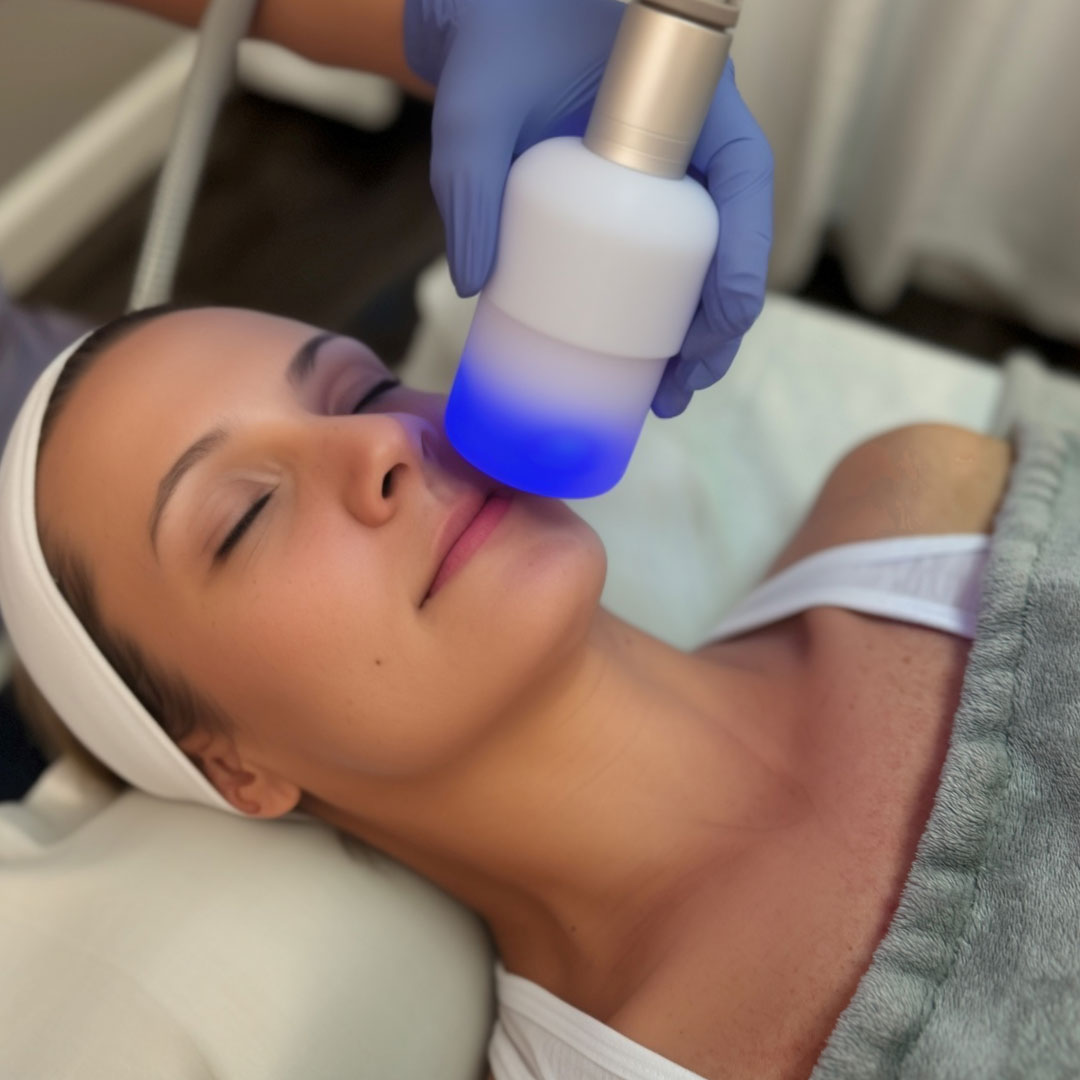 cryo-facial-decolette cryo facial lake mary